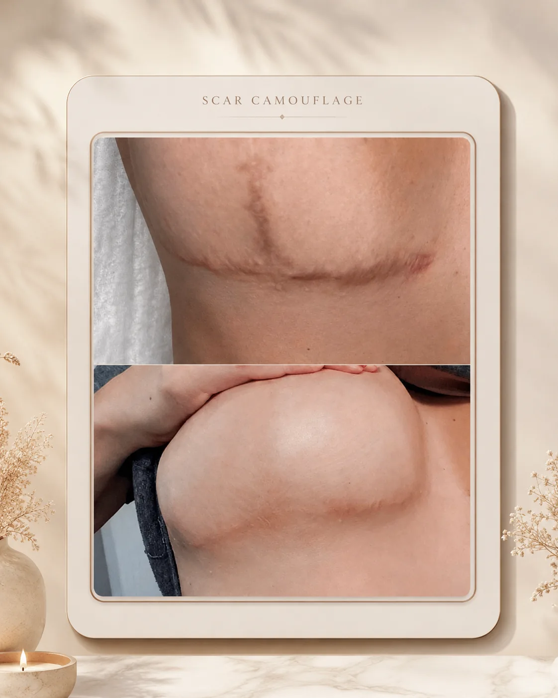 Chest scar camouflage, before and after